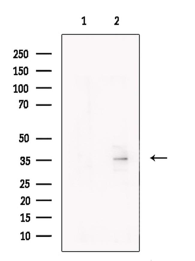 CD1a Antibody in Western Blot (WB)