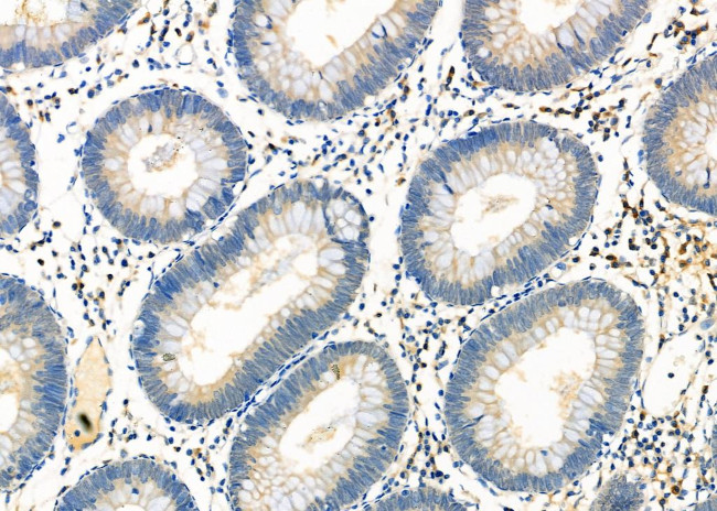 CD26 Antibody in Immunohistochemistry (Paraffin) (IHC (P))