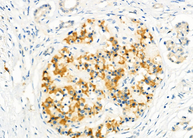 CD26 Antibody in Immunohistochemistry (Paraffin) (IHC (P))