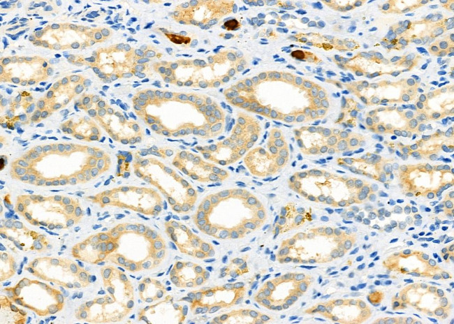 CD26 Antibody in Immunohistochemistry (Paraffin) (IHC (P))