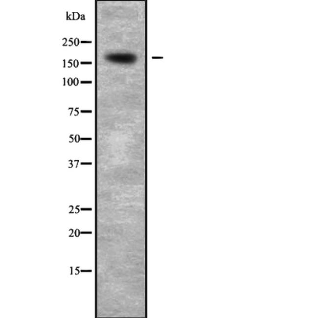 CDK12 Antibody in Western Blot (WB)