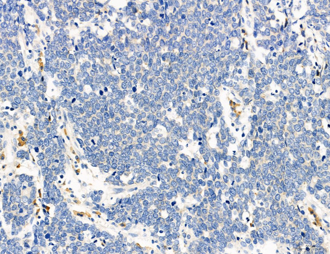 CD44 Antibody in Immunohistochemistry (Paraffin) (IHC (P))