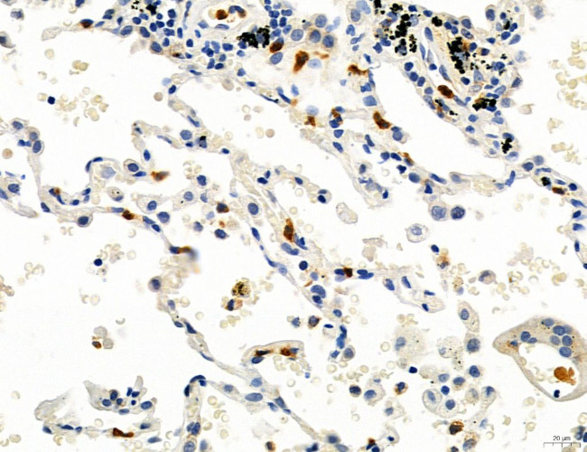 CD44 Antibody in Immunohistochemistry (Paraffin) (IHC (P))