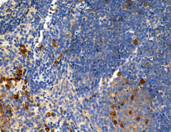 CD44 Antibody in Immunohistochemistry (Paraffin) (IHC (P))