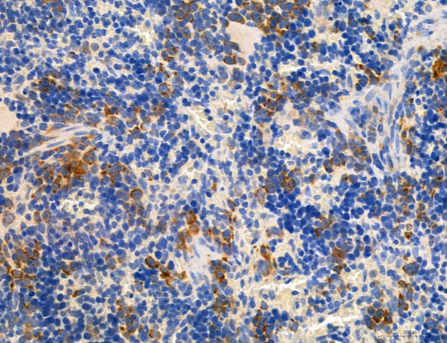 CD44 Antibody in Immunohistochemistry (Paraffin) (IHC (P))