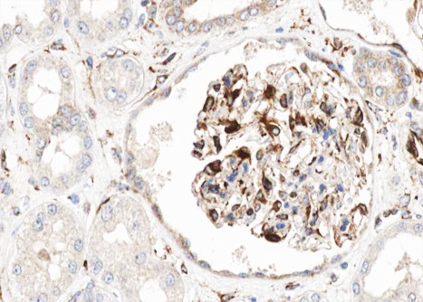 H-cadherin Antibody in Immunohistochemistry (Paraffin) (IHC (P))