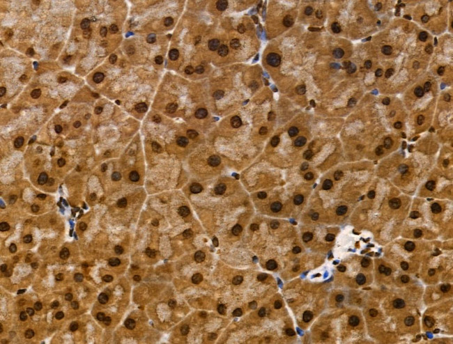 CDK8 Antibody in Immunohistochemistry (Paraffin) (IHC (P))