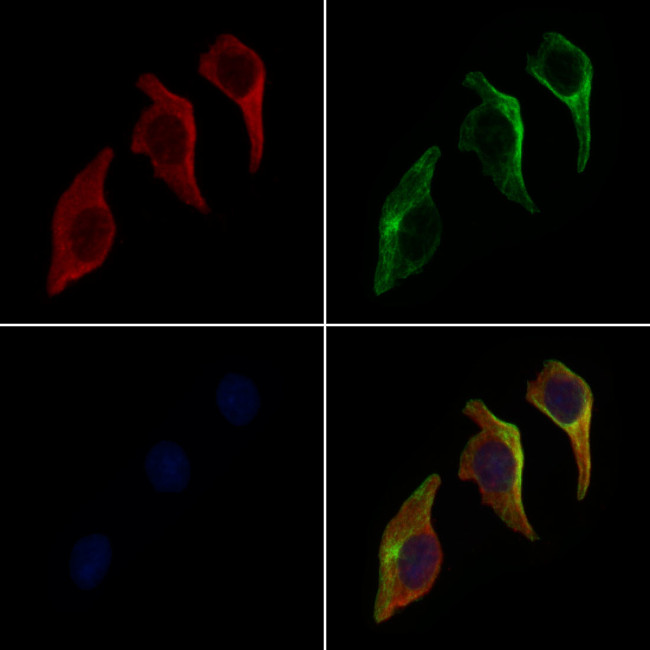 CEL Antibody in Immunocytochemistry (ICC/IF)