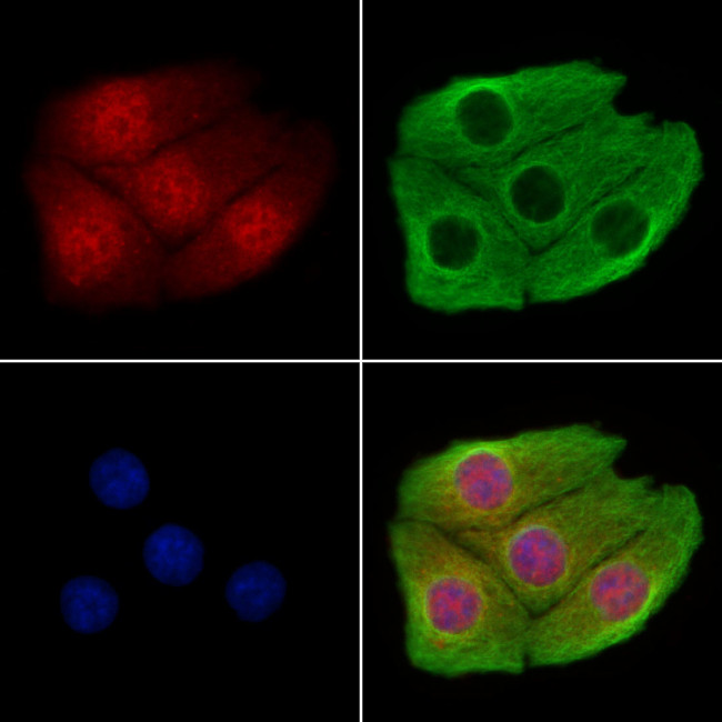 CHD4 Antibody in Immunocytochemistry (ICC/IF)