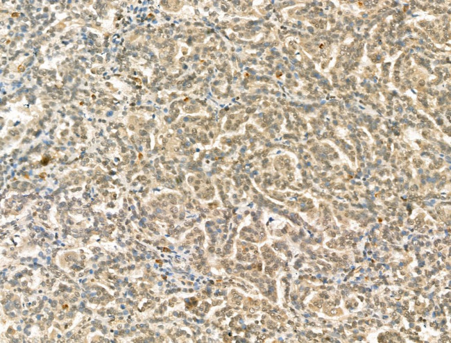 CHD4 Antibody in Immunohistochemistry (Paraffin) (IHC (P))