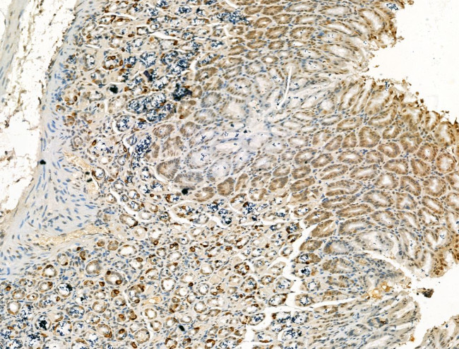 CHD4 Antibody in Immunohistochemistry (Paraffin) (IHC (P))