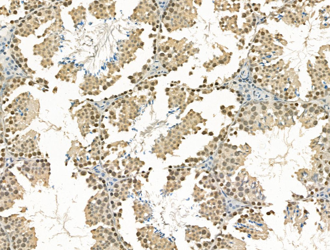 CHD4 Antibody in Immunohistochemistry (Paraffin) (IHC (P))