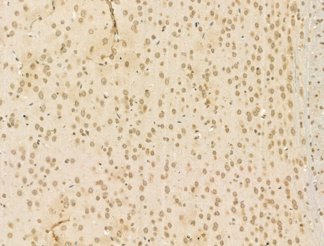 CHD4 Antibody in Immunohistochemistry (Paraffin) (IHC (P))