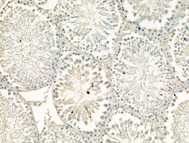 CHD4 Antibody in Immunohistochemistry (Paraffin) (IHC (P))