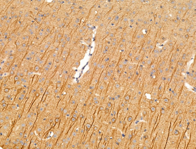 Chordin Antibody in Immunohistochemistry (Paraffin) (IHC (P))