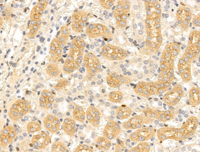 Chordin Antibody in Immunohistochemistry (Paraffin) (IHC (P))