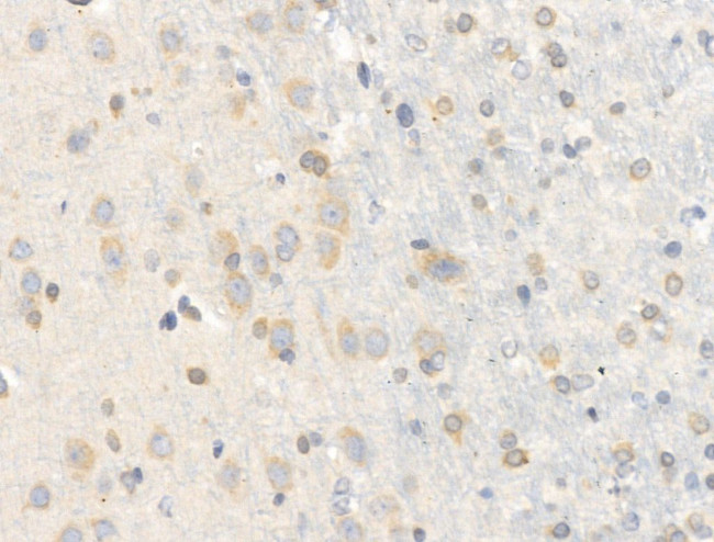 Chordin Antibody in Immunohistochemistry (Paraffin) (IHC (P))