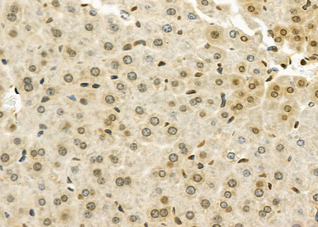 CHRM4 Antibody in Immunohistochemistry (Paraffin) (IHC (P))