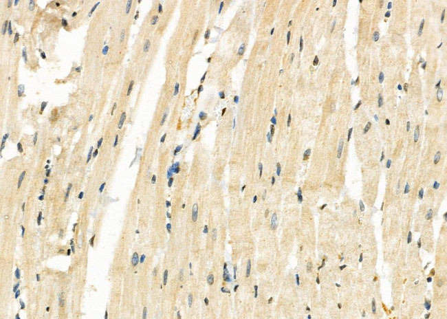 CHRM4 Antibody in Immunohistochemistry (Paraffin) (IHC (P))