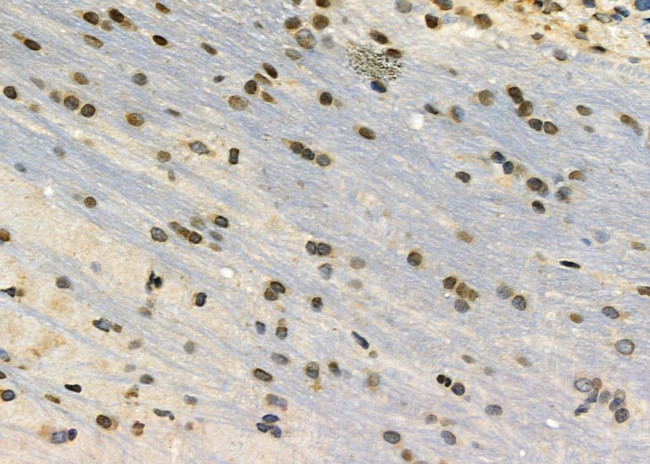 CHRM4 Antibody in Immunohistochemistry (Paraffin) (IHC (P))