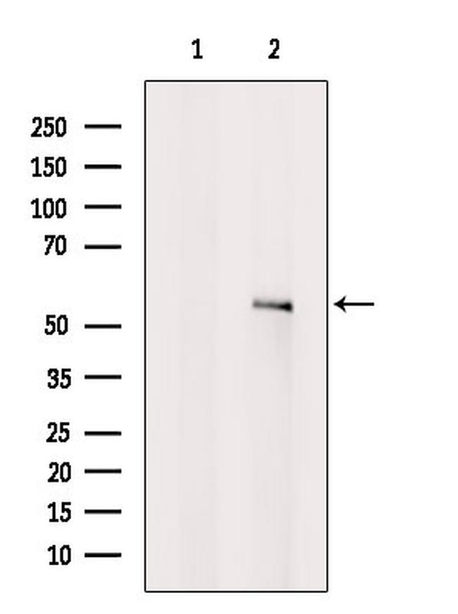 CHRM4 Antibody in Western Blot (WB)