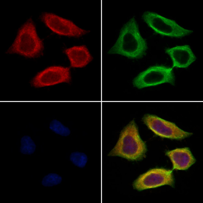 Chromogranin C Antibody in Immunocytochemistry (ICC/IF)