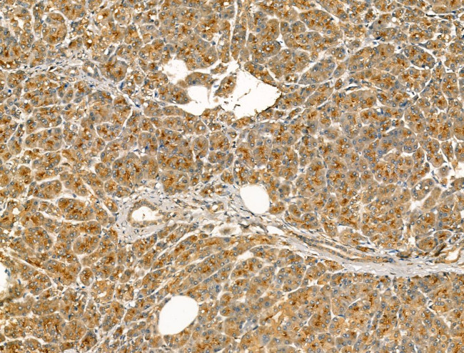 Chromogranin C Antibody in Immunohistochemistry (Paraffin) (IHC (P))