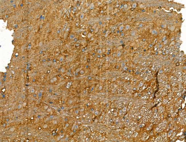 Chromogranin C Antibody in Immunohistochemistry (Paraffin) (IHC (P))