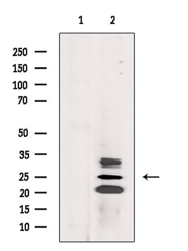 CIDEA Antibody in Western Blot (WB)