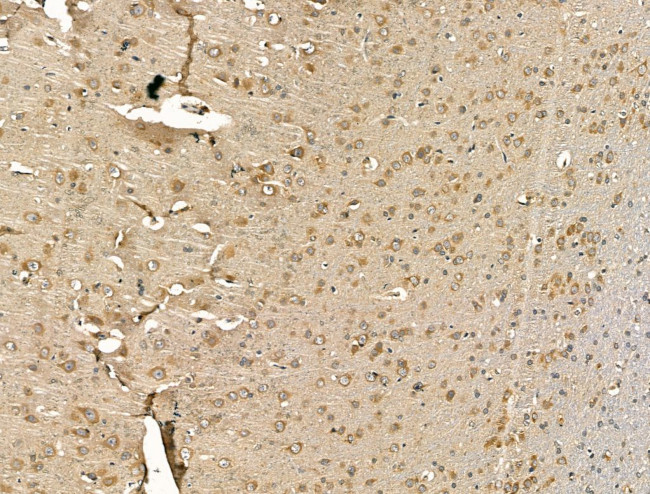 Citrate Synthase Antibody in Immunohistochemistry (Paraffin) (IHC (P))