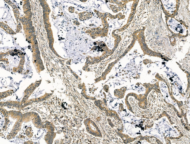 Citrate Synthase Antibody in Immunohistochemistry (Paraffin) (IHC (P))