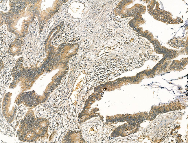 Citrate Synthase Antibody in Immunohistochemistry (Paraffin) (IHC (P))