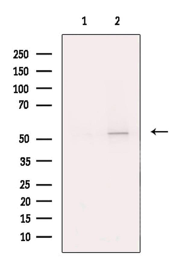 Citrate Synthase Antibody in Western Blot (WB)