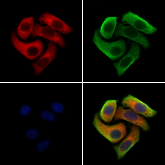 Clathrin Heavy Chain Antibody in Immunocytochemistry (ICC/IF)