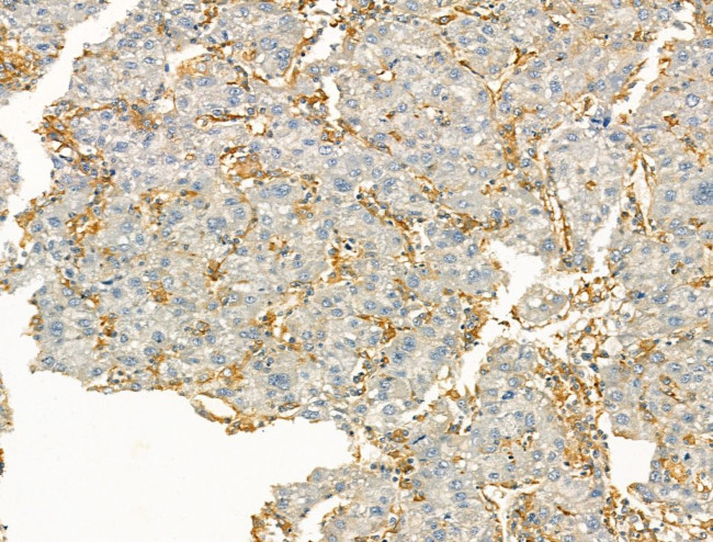 Clathrin Heavy Chain Antibody in Immunohistochemistry (Paraffin) (IHC (P))