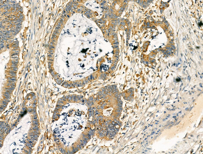 Clathrin Heavy Chain Antibody in Immunohistochemistry (Paraffin) (IHC (P))