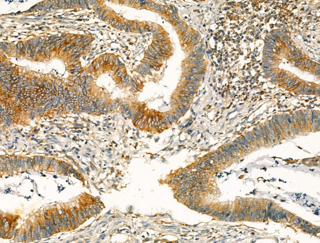 Clathrin Heavy Chain Antibody in Immunohistochemistry (Paraffin) (IHC (P))