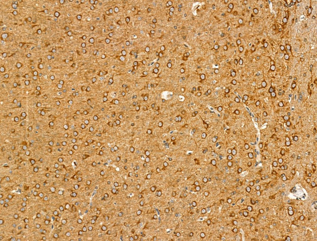 Clathrin Heavy Chain Antibody in Immunohistochemistry (Paraffin) (IHC (P))