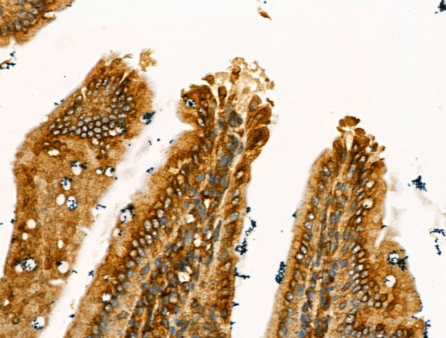 Clathrin Heavy Chain Antibody in Immunohistochemistry (Paraffin) (IHC (P))