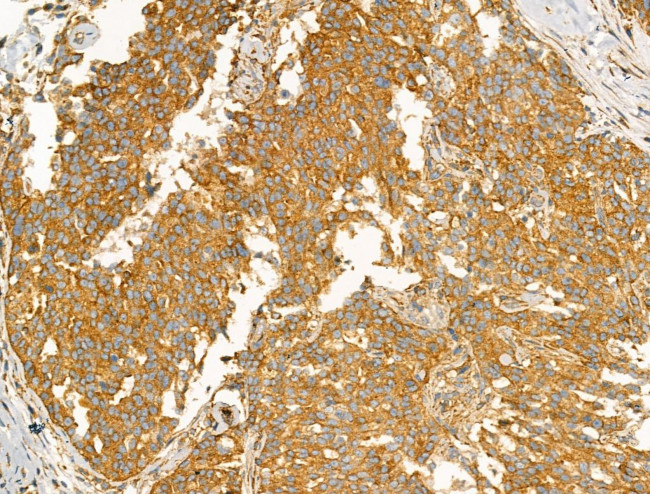 Clathrin Heavy Chain Antibody in Immunohistochemistry (Paraffin) (IHC (P))