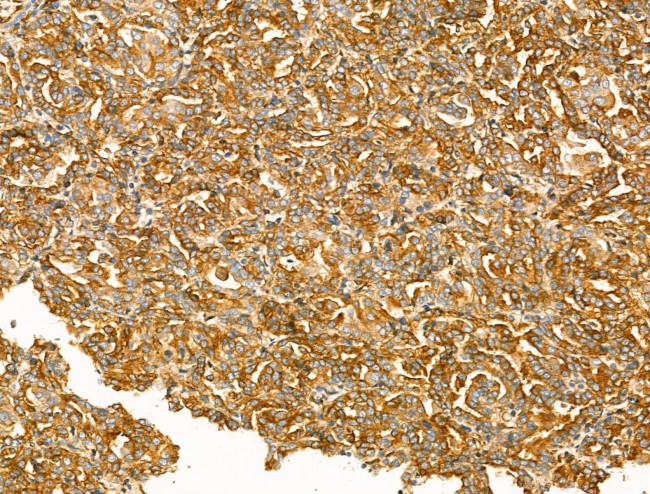 Clathrin Heavy Chain Antibody in Immunohistochemistry (Paraffin) (IHC (P))