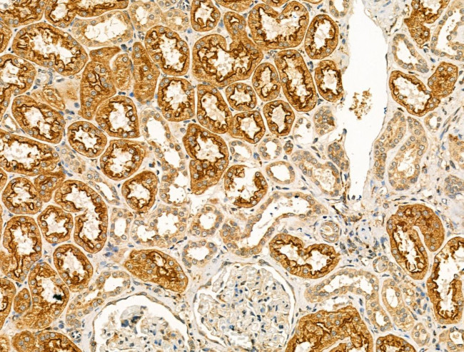 Clathrin Heavy Chain Antibody in Immunohistochemistry (Paraffin) (IHC (P))