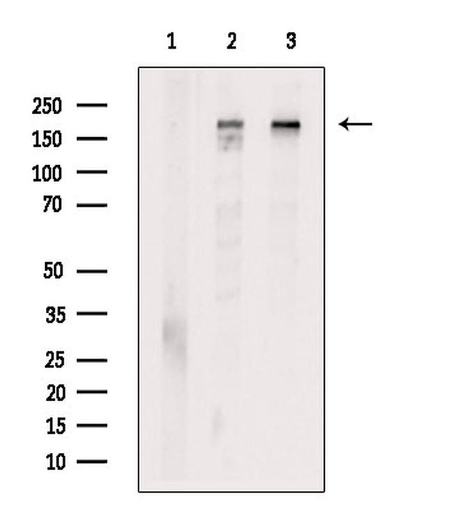 Clathrin Heavy Chain Antibody in Western Blot (WB)