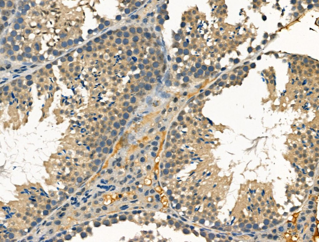 Clathrin Heavy Chain Antibody in Immunohistochemistry (Paraffin) (IHC (P))