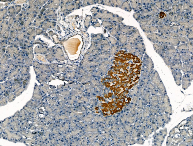 Clathrin Heavy Chain Antibody in Immunohistochemistry (Paraffin) (IHC (P))