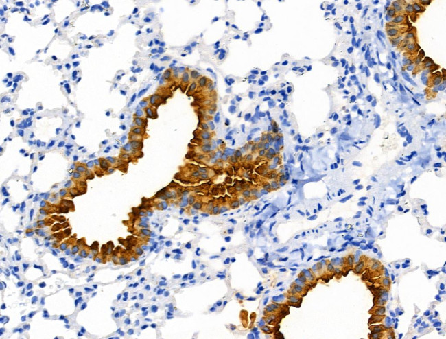 Cofilin 1/2 Antibody in Immunohistochemistry (Paraffin) (IHC (P))