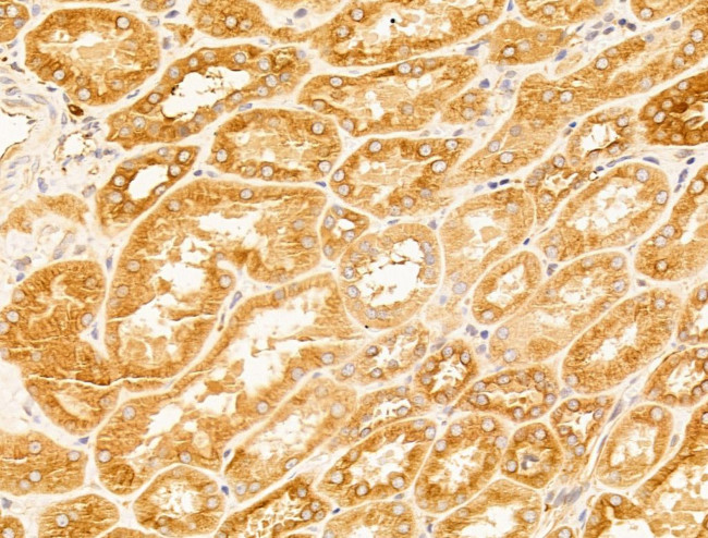 CERT Antibody in Immunohistochemistry (Paraffin) (IHC (P))