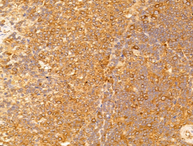 CERT Antibody in Immunohistochemistry (Paraffin) (IHC (P))