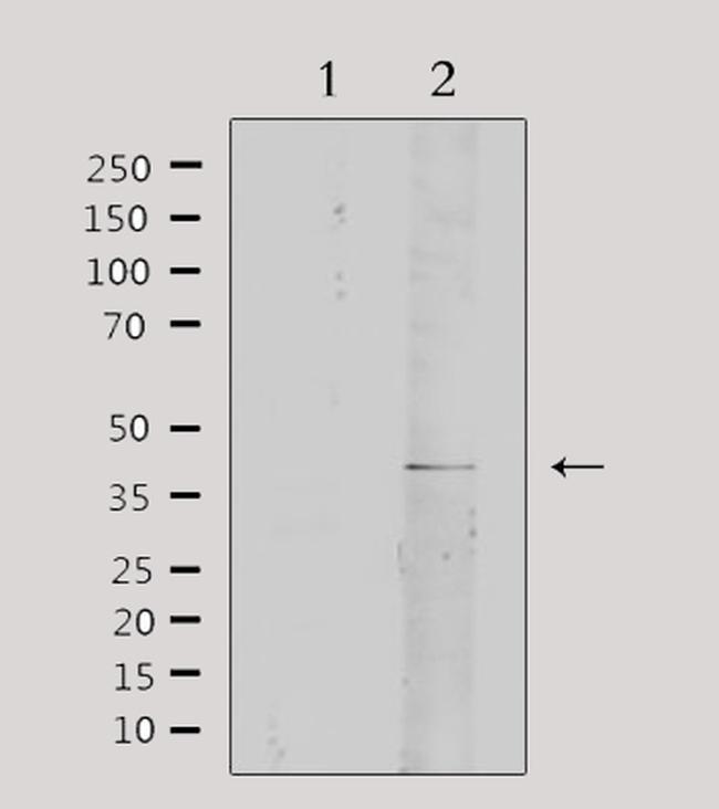 Collagen IV Antibody in Western Blot (WB)