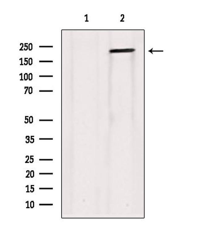 Collagen V Antibody in Western Blot (WB)